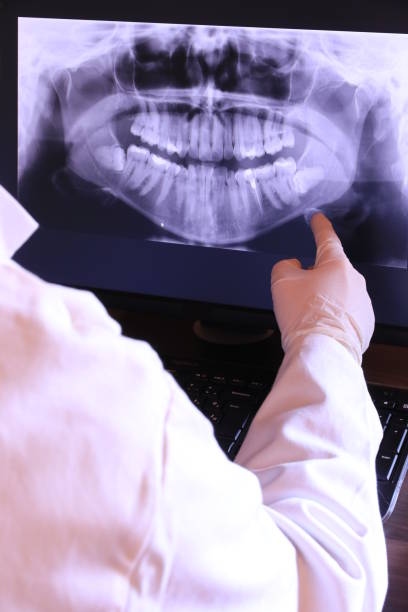 Best Dental Abscess Treatment in Walnut Creek, CA
