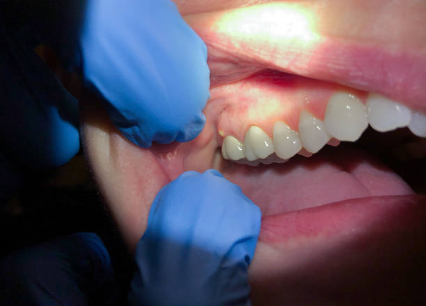 Best 24-Hour Emergency Dental Care in Walnut Creek, CA